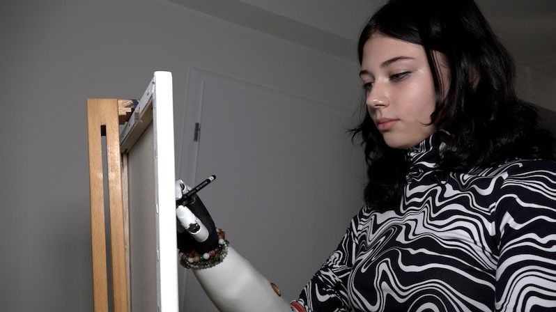 V patnácti letech přišla kvůli rakovině o ruku. Díky protéze může Amálka i nadále malovat